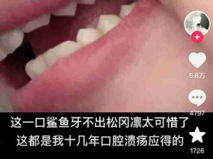 什么，原来真的有鲨鱼牙